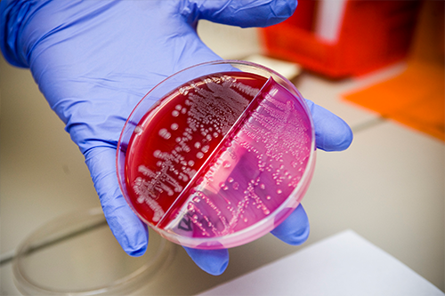 E. Coli bacteria - Escherichia coli